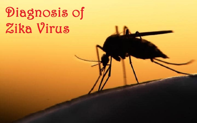 Diagnosis of Zika Virus