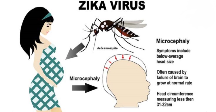 Diagnosis of Zika Virus