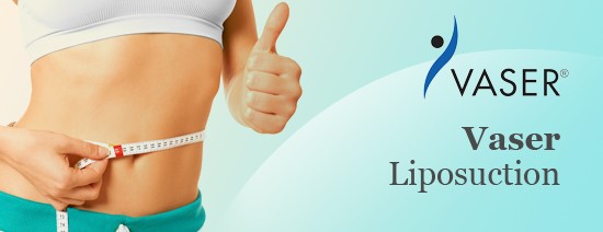 Liposuction Without Major Surgery